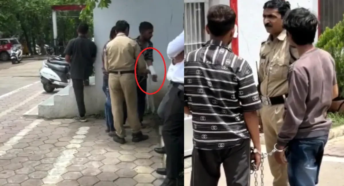 डॉक्टर ने कहा- कोई प्लास्टर नहीं लगाया, जांच में कई पुलिसकर्मी घेरे में