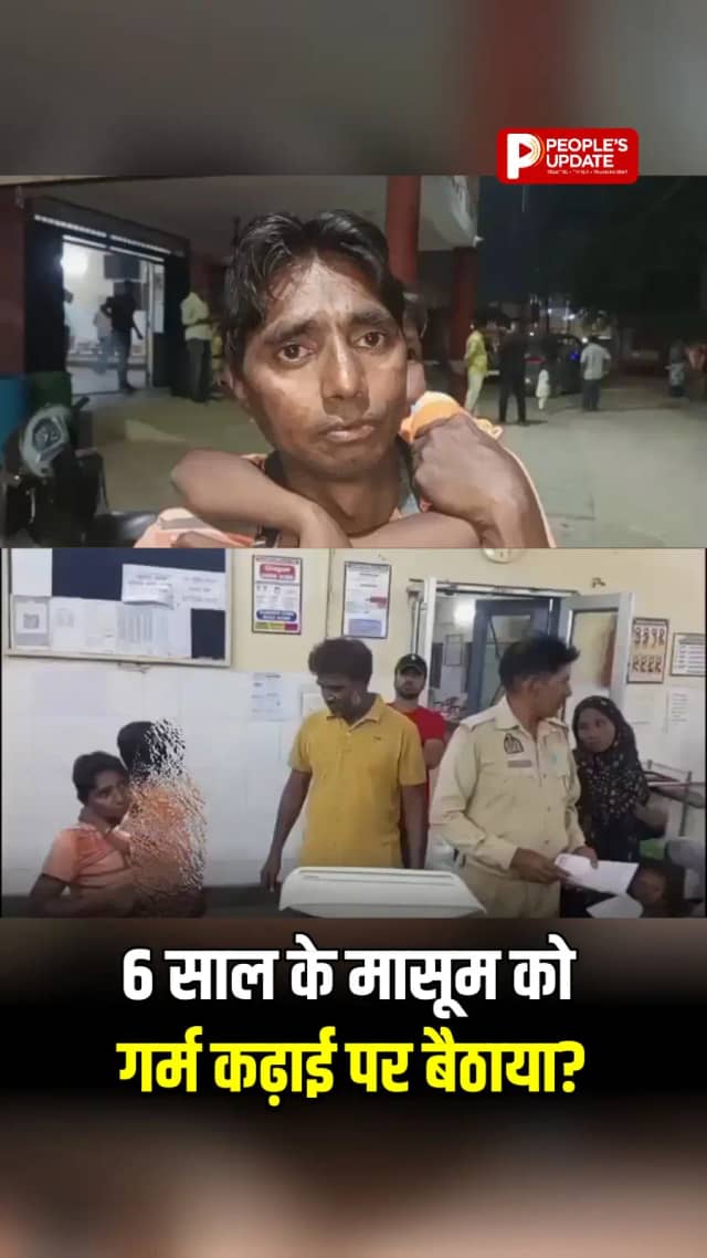 अलीगढ़ में 6 साल के बच्चे से क्रूरता का आरोप, गर्म कढ़ाई पर बैठाने की शिकायत