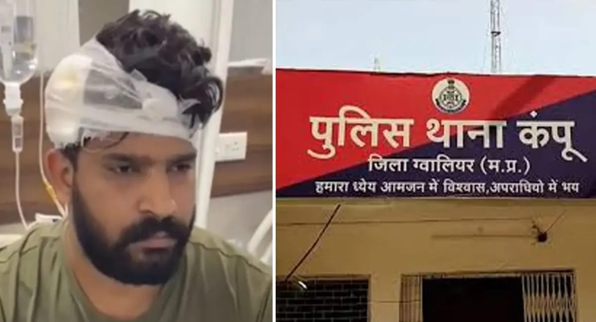 ओवरटेक कर बदमाशों ने बरसाईं गोलियां, गैराज संचालक घायल