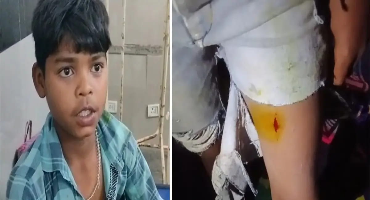 14 साल के सत्यम खुद को बचाने भिड़ा, हाथ- पैर में चोटें, वन विभाग ने कराया इलाज