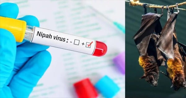 Nipah Virus : मलप्पुरम में निपाह वायरस से युवक की मौत, केरल की स्वास्थ्य मंत्री ने की पुष्टि; संपर्क में आए 151 लोगों की बनाई लिस्ट