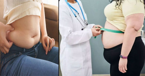 मोटापे से परेशान... पाना चाहते हैं छुटकारा तो भूलकर भी न करें ये काम