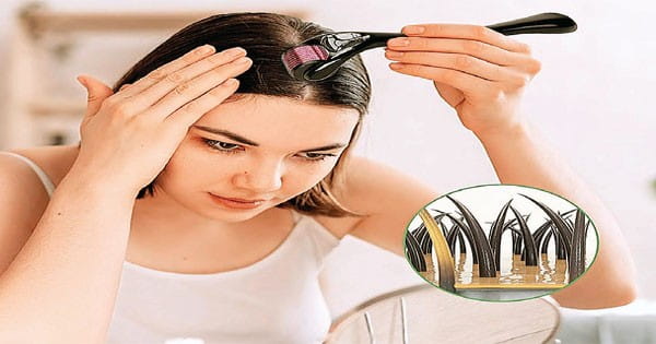 हेयर ग्रोथ के लिए आए डर्मा रोलर, बेहतर रिजल्ट के लिए मेडिकल एडवाइस जरूरी