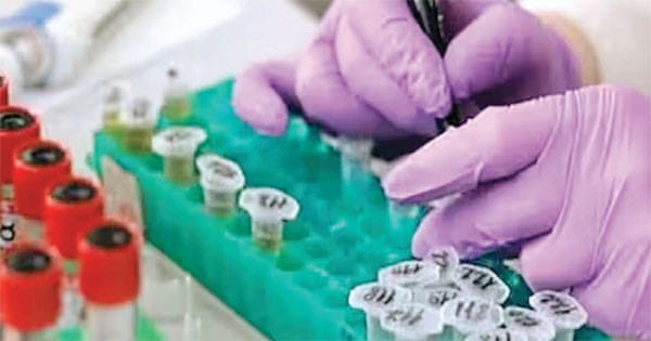 ऑस्ट्रेलियाई लैब से गायब हुए वायरस के 323 सैंपल्स, दुनियाभर में अलर्ट जारी