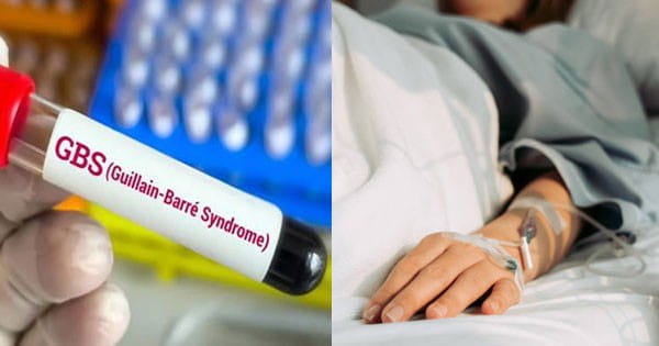 महाराष्ट्र में ‘गुइलेन-बैरे सिंड्रोम’ (GBS) से 7वीं मौत, 37 साल के युवक ने तोड़ा दम; 167 कंफर्म केस, वेंटिलेटर पर 21 मरीज