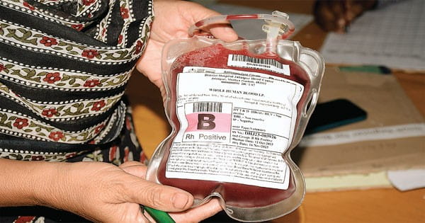 कोडिंग से होगी सिकल सेल एनीमिया मरीजों की मॉनिटरिंग
