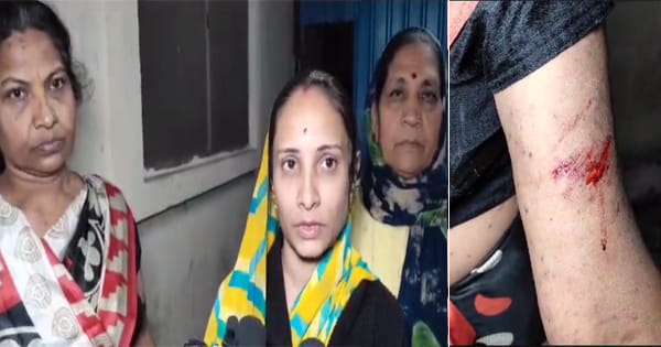 इंदौर : चुनाव में बीजेपी को दिया समर्थन इसलिए कांग्रेस कार्यकर्ताओं ने कर दिया चाकू से हमला, युवक की हालत गंभीर; देखें VIDEO